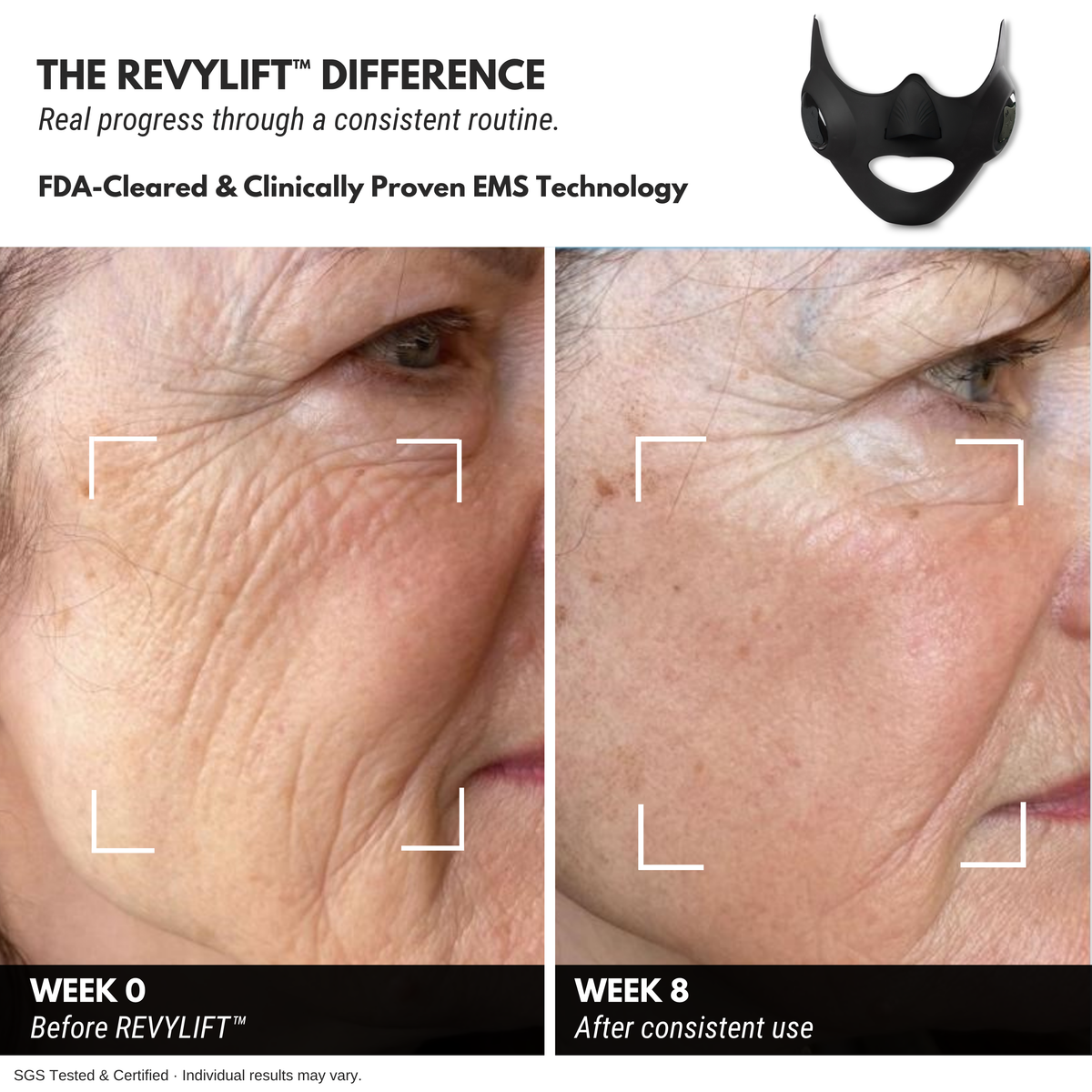 REVYLIFT™ PRO-GRADE EMS MASK