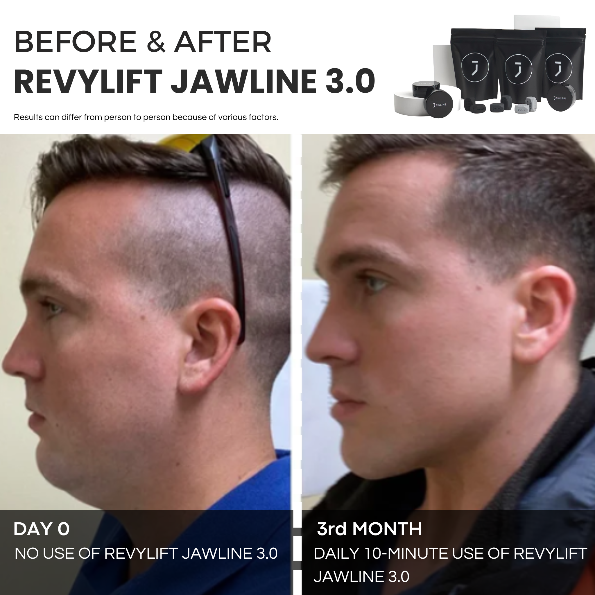 REVYLIFT™ JAWLINE 3.0