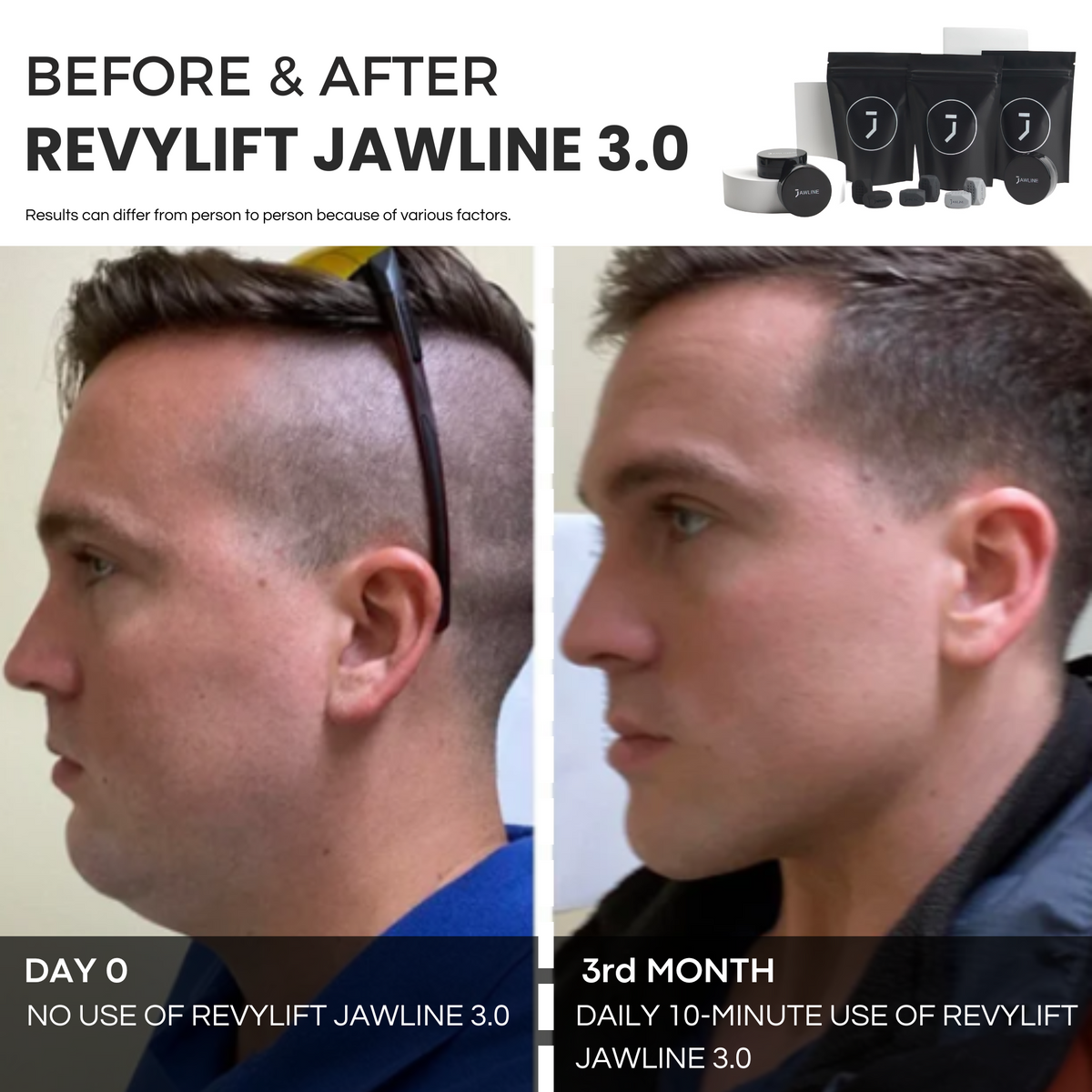 REVYLIFT™ JAWLINE 3.0 Jaw Trainer - REVYLIFT