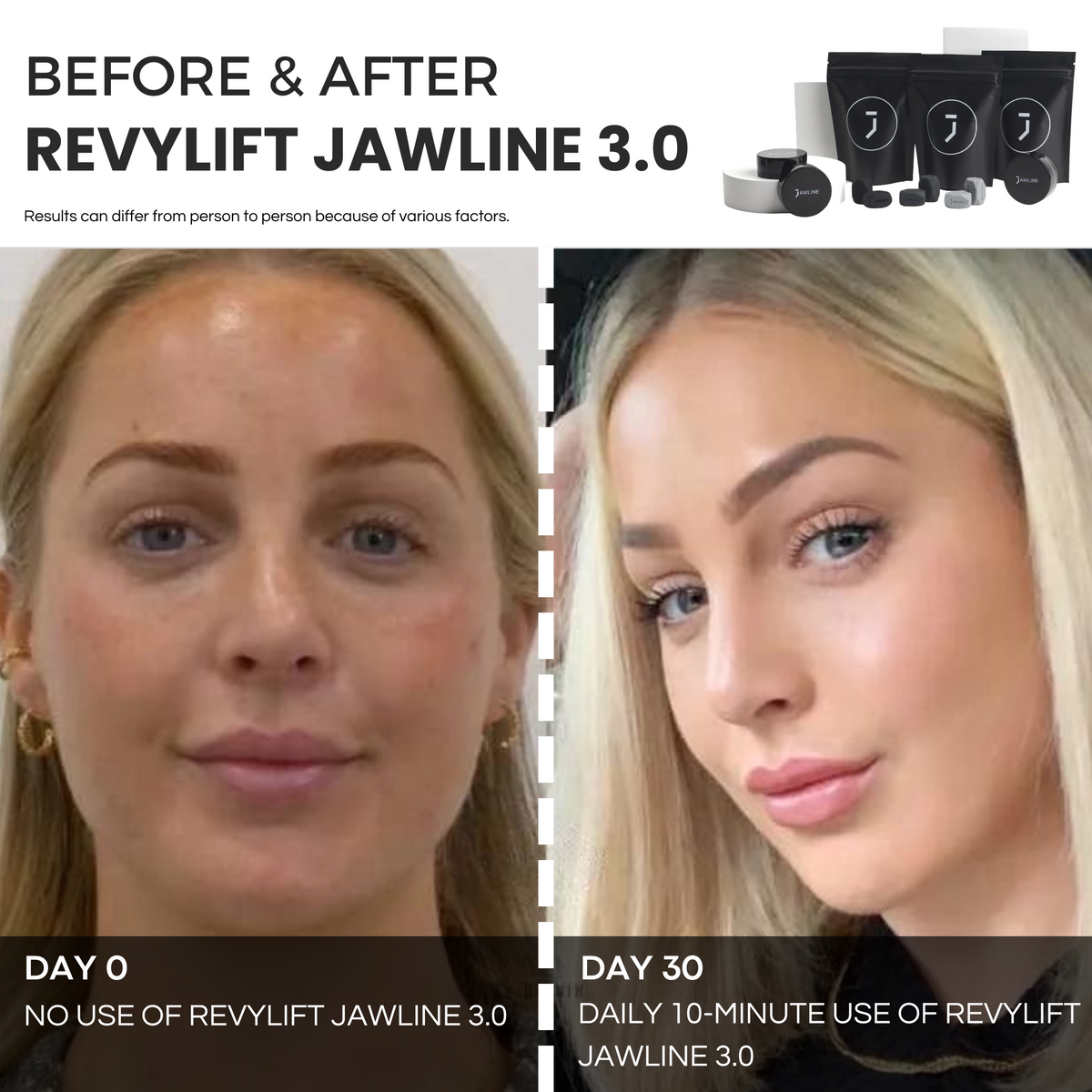 REVYLIFT™ JAWLINE 3.0 Jaw Trainer - REVYLIFT