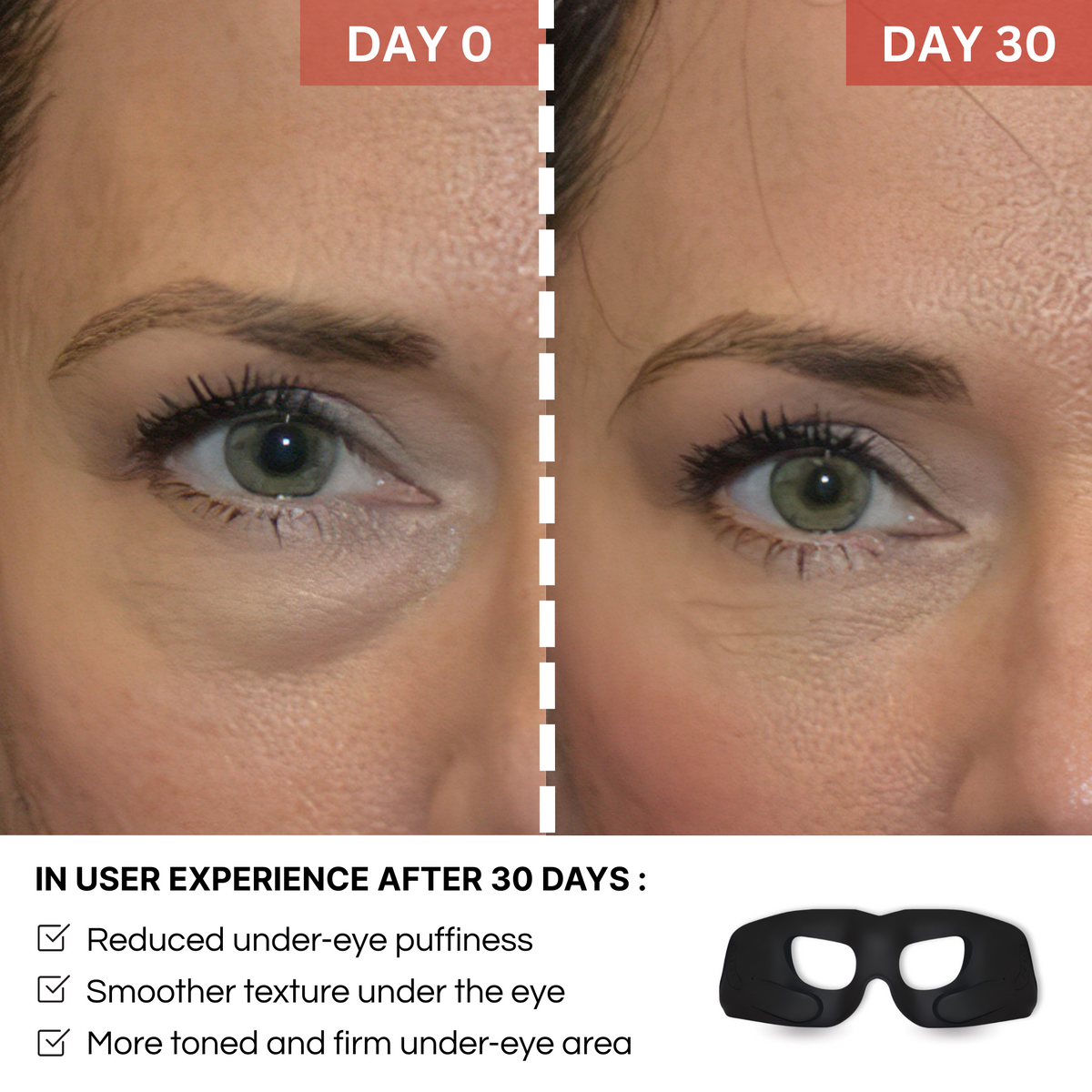 REVYLIFT™ Rejuvenating EMS Eye Mask - REVYLIFT