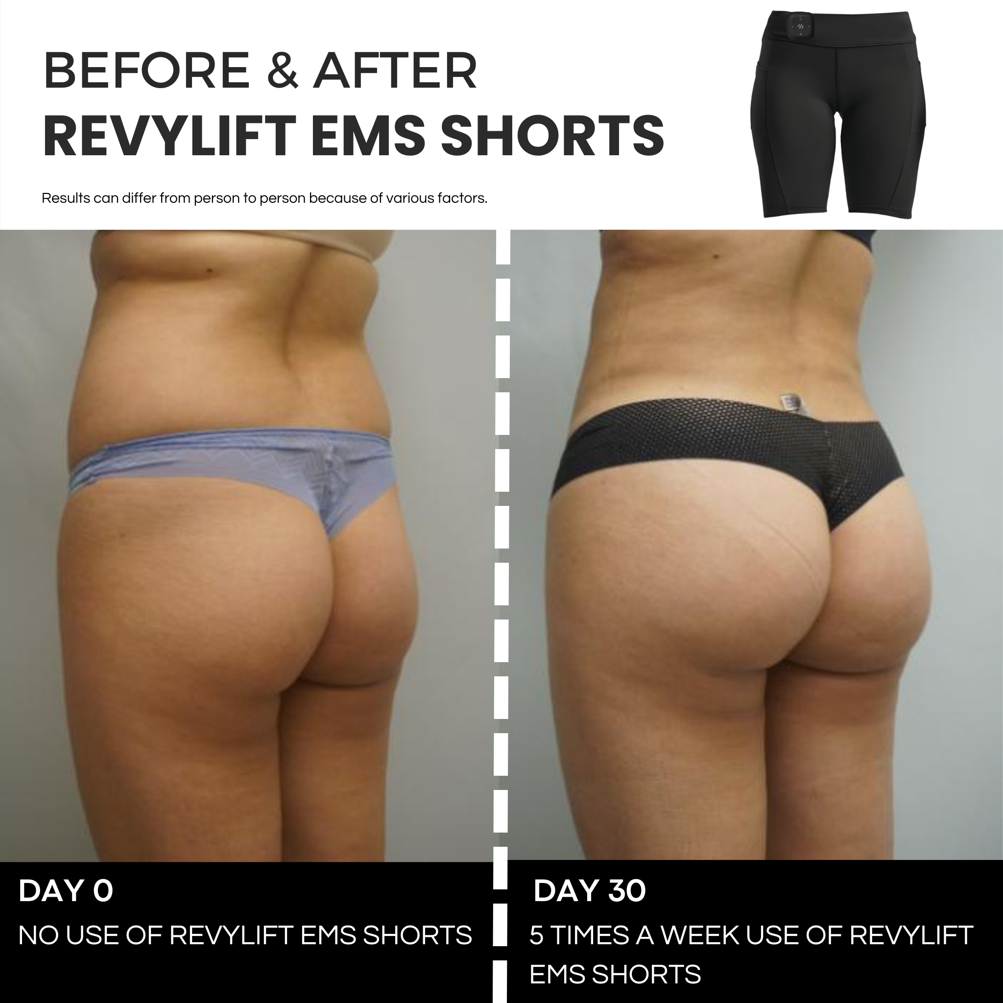 REVYLIFT™ EMS TONING SHORTS