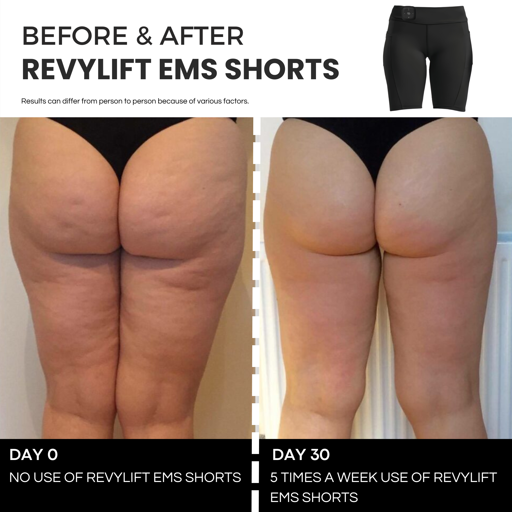 REVYLIFT™ EMS TONING SHORTS