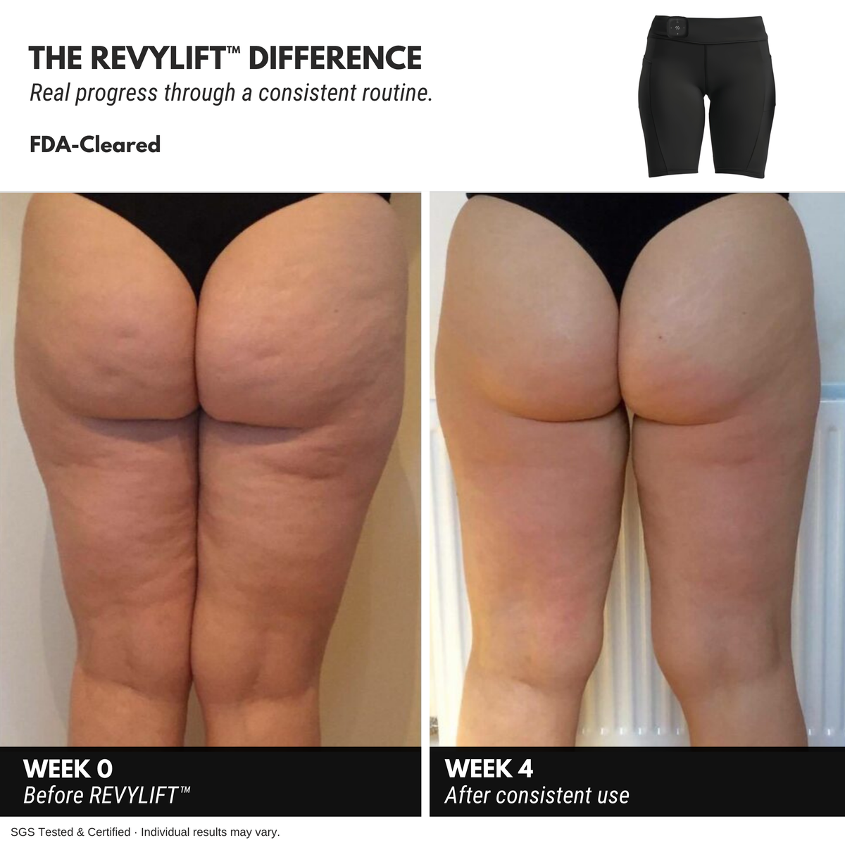 REVYLIFT™ EMS Toning Shorts - REVYLIFT