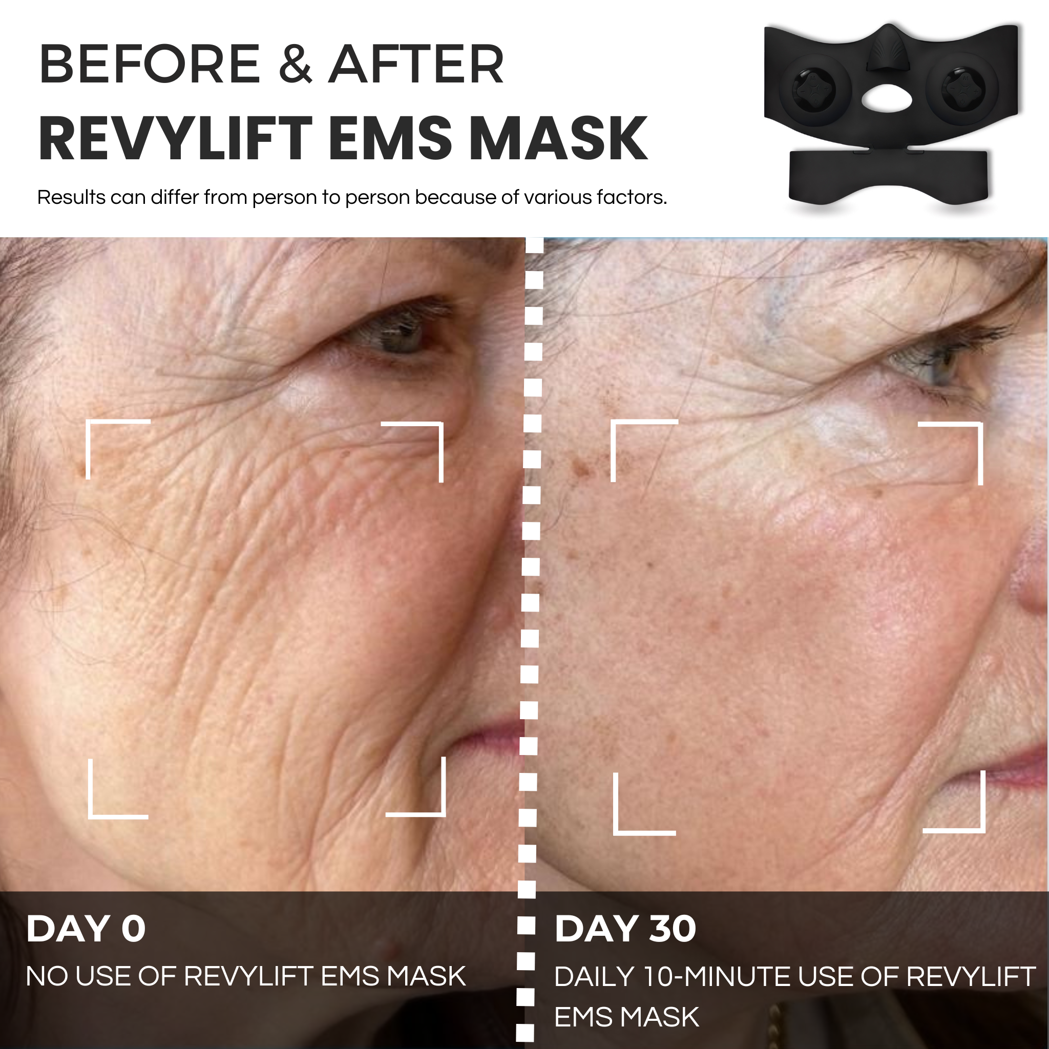 REVYLIFT™ PRO-GRADE EMS MASK