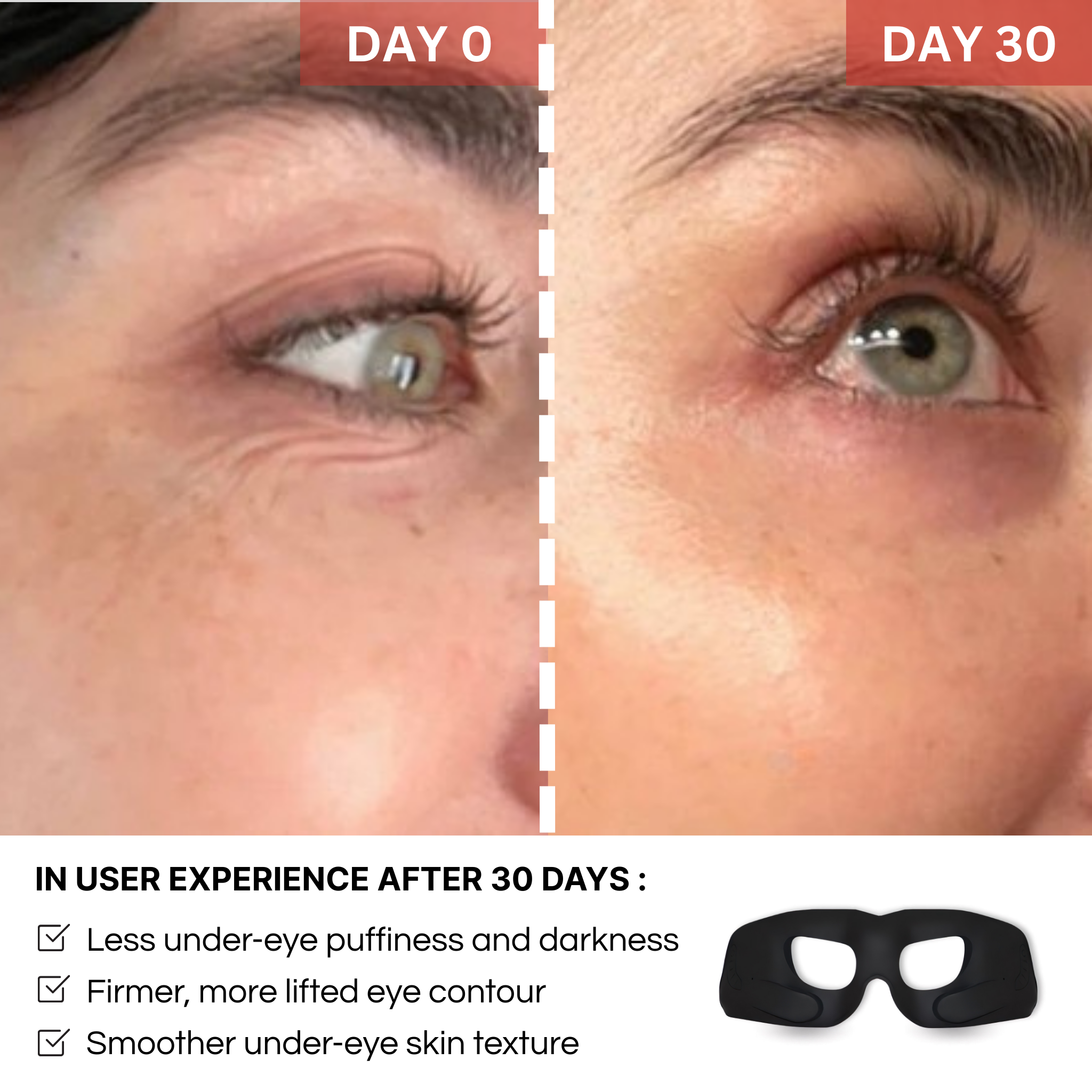 REVYLIFT™ EMS EYE MASK