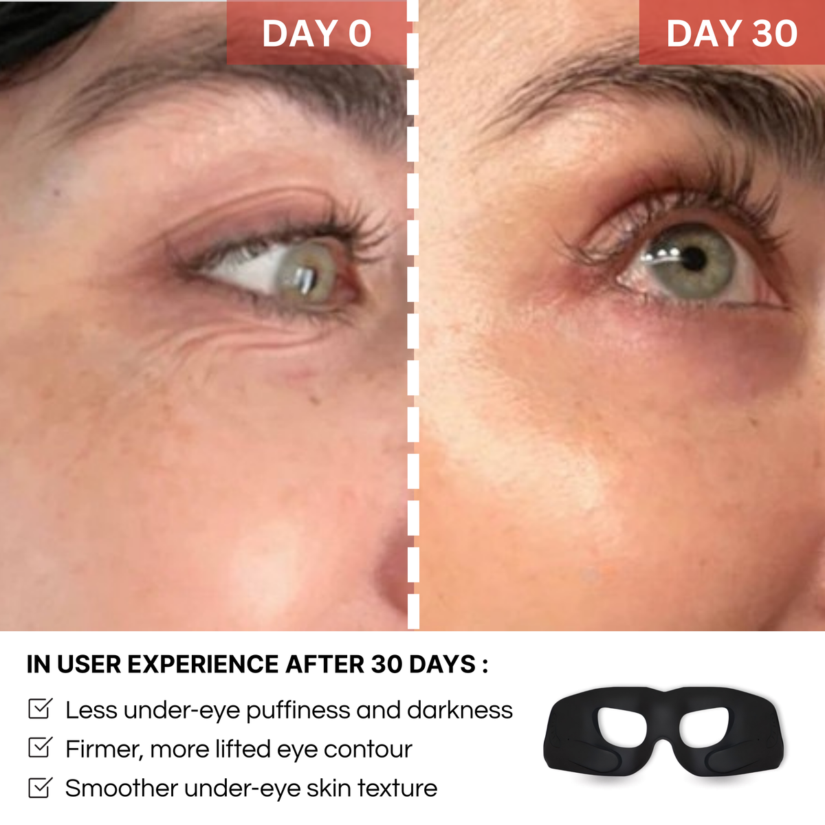REVYLIFT™ Rejuvenating EMS Eye Mask - REVYLIFT