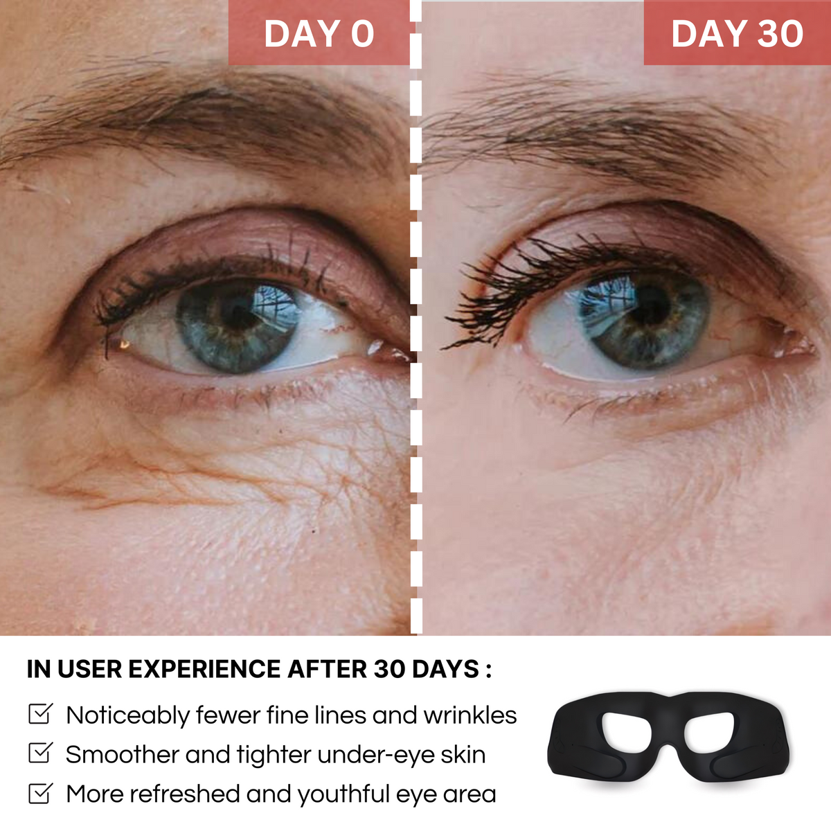 REVYLIFT™ Rejuvenating EMS Eye Mask - REVYLIFT