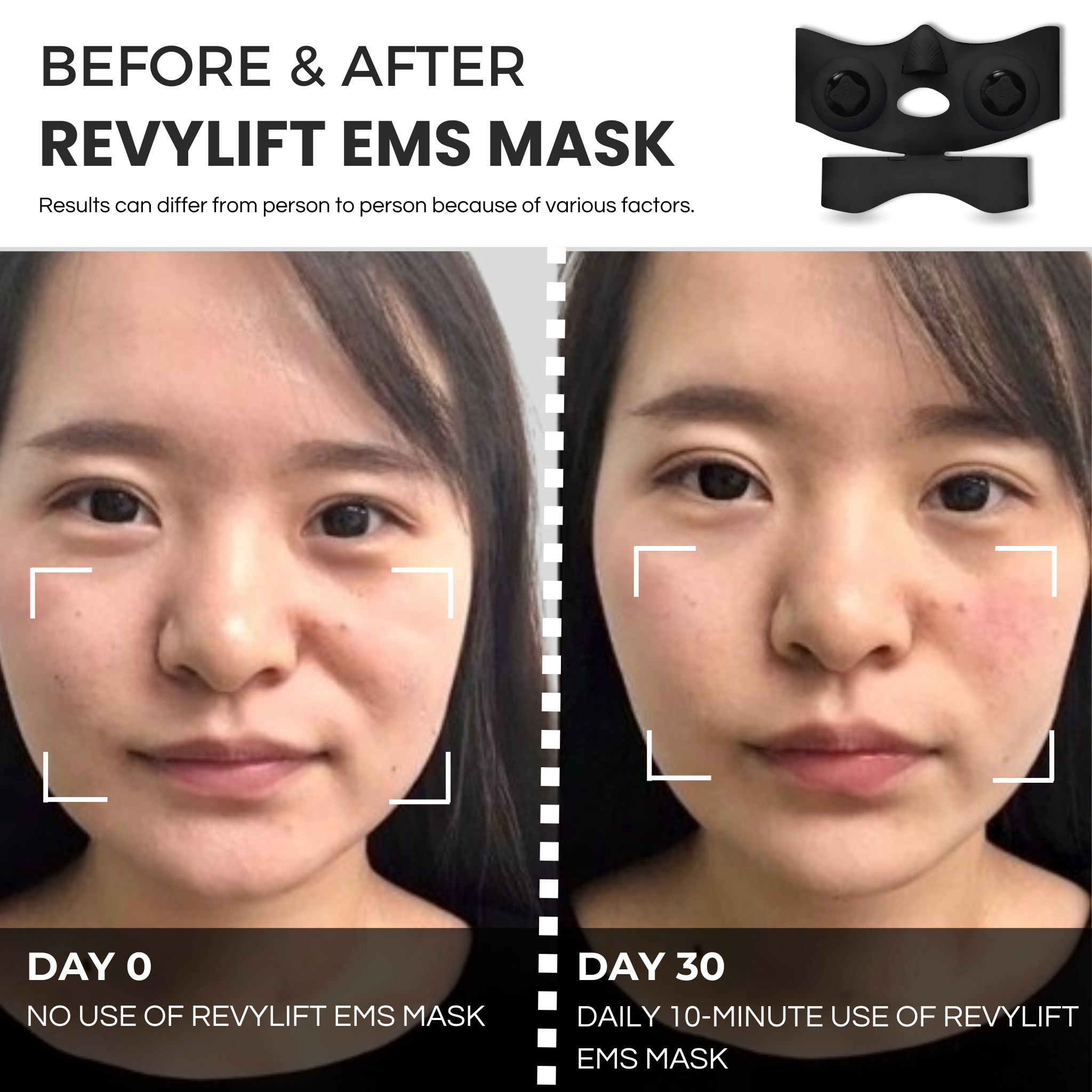REVYLIFT™ PRO-GRADE EMS MASK