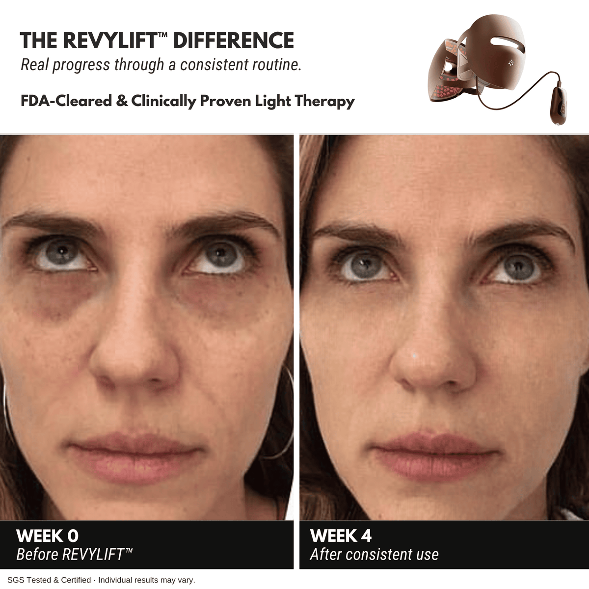 REVYLIFT™ 9D Precision Laser Mask - REVYLIFT