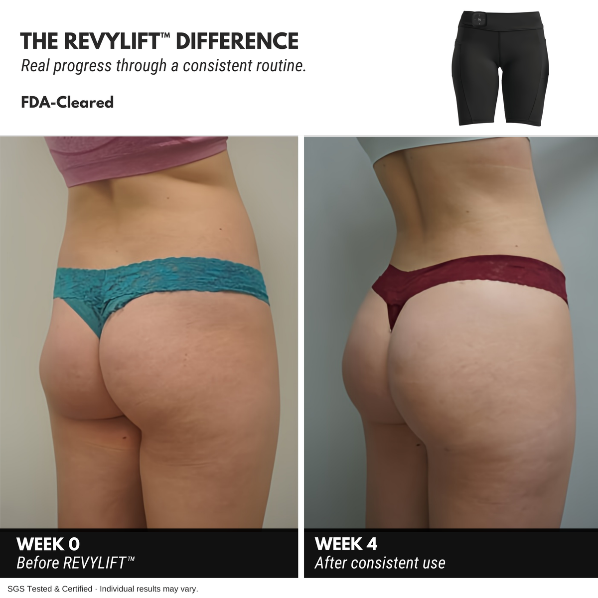 REVYLIFT™ EMS Toning Shorts - REVYLIFT