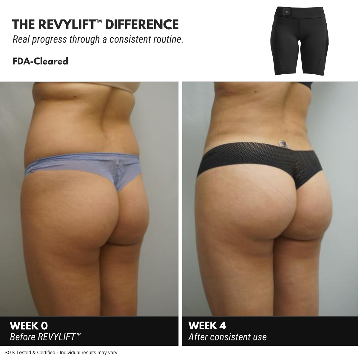 REVYLIFT™ EMS Toning Shorts - REVYLIFT