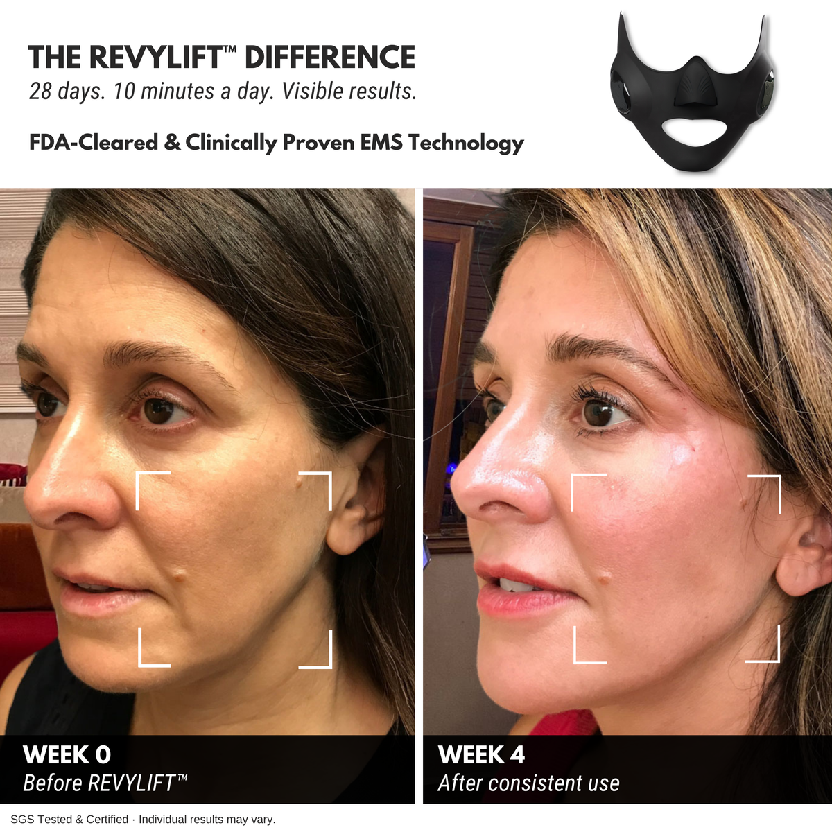 REVYLIFT™ PRO-GRADE EMS MASK