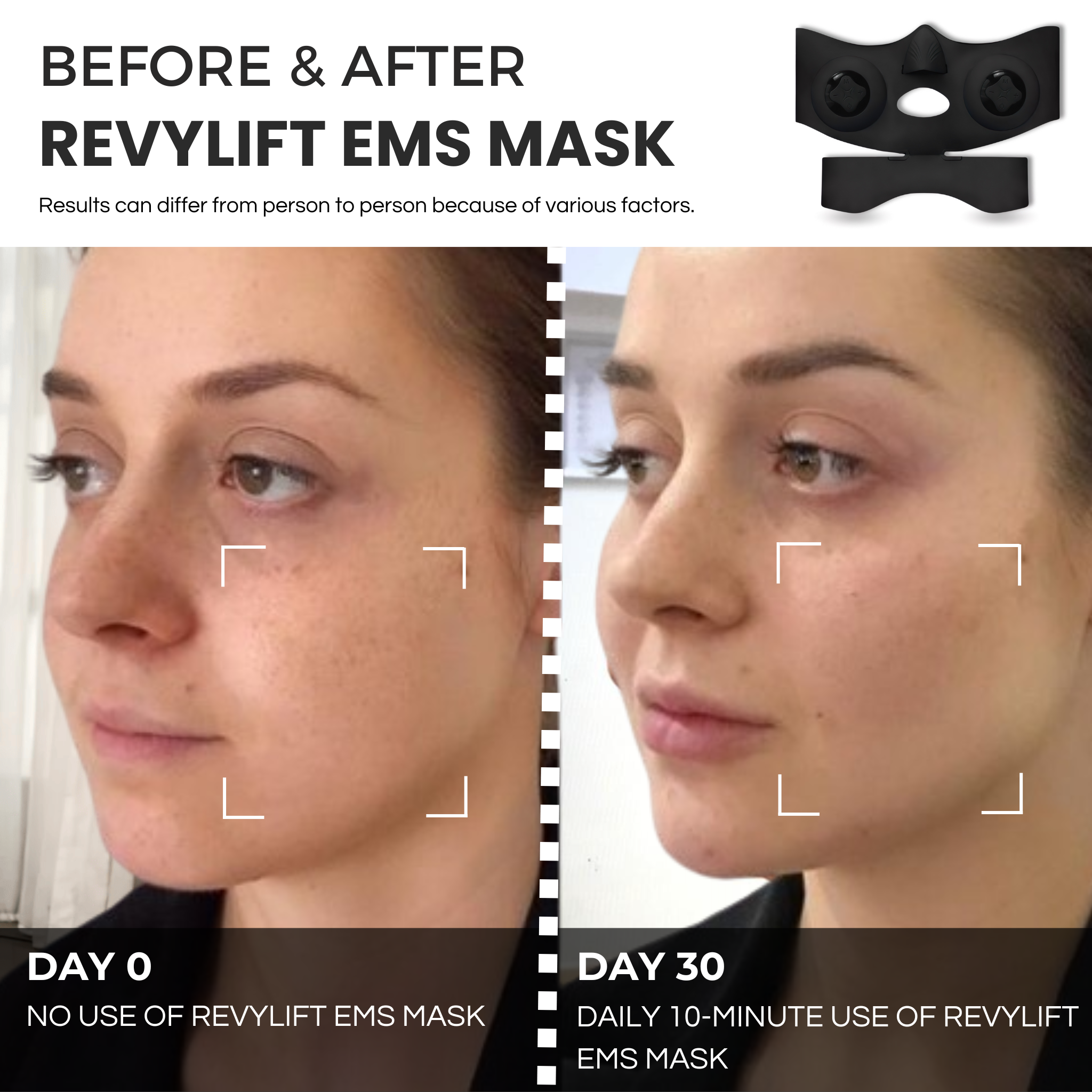 REVYLIFT™ PRO-GRADE EMS MASK
